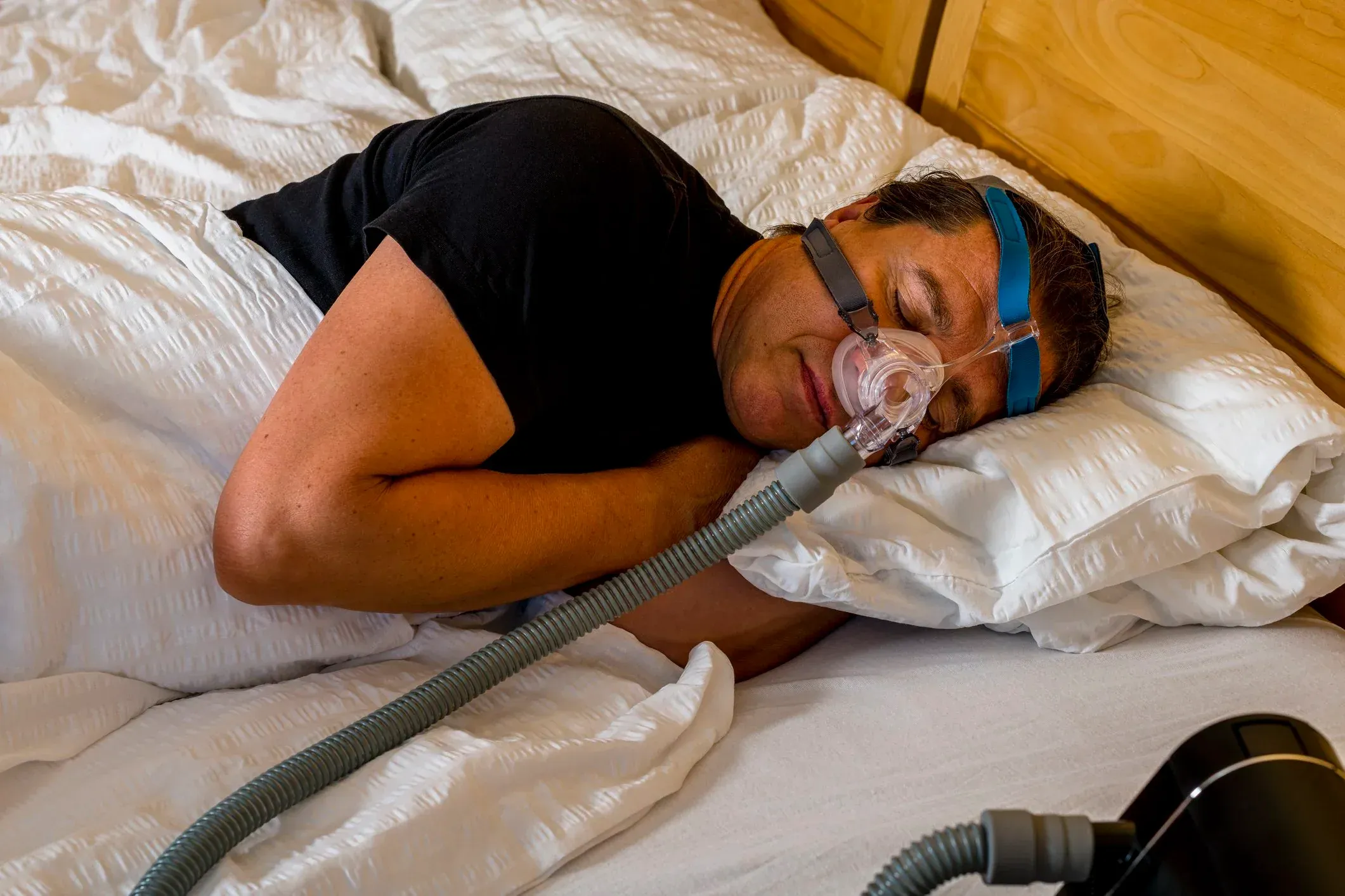 Man asleep on his side in bed wearing a nasal CPAP mask, its ribbed hose running across the pillow